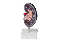 Модель почки в разрезе - fgospostavki.ru - Белово