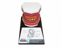 Демонстрационная модель "Ротовая полость курильщика" - fgospostavki.ru - Белово