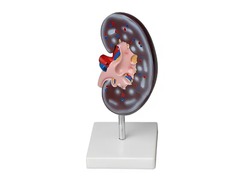 Модель почки в разрезе - fgospostavki.ru - Белово