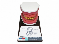 Демонстрационная модель "Ротовая полость курильщика" - fgospostavki.ru - Белово