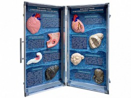 Учебно-демонстрационный кейс "Последствия употребления алкоголя и наркотиков" - fgospostavki.ru - Белово